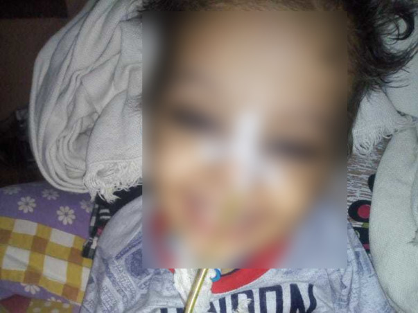 2 Years Old Aditi Kumari Needs Your help Fight Neuro Disease