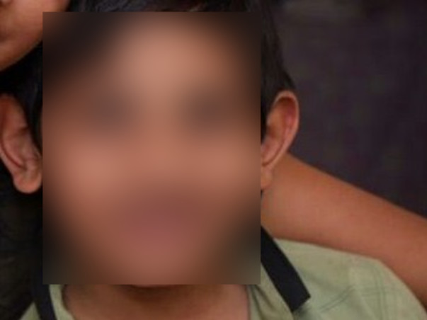 Help my son fight cochlear implant for sensorineural hearing loss treatment