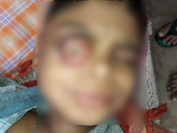 Help My 12 Years Old Son Vansh Fight Cancer.