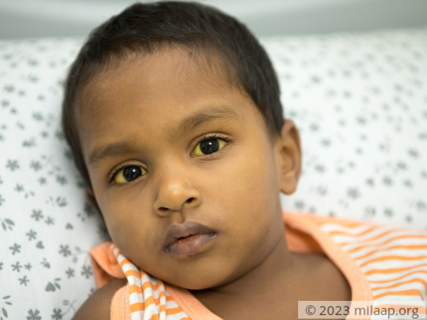 Weaver Begs Village To Save His 3-year-old Son From Liver Failure
