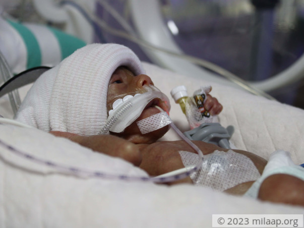 Palm-sized Preemie Fights To Stay Alive While Parents Plead For Help
