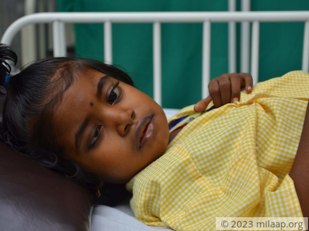 She Lost Her Eye To Cancer, She Will Lose Her Life To It Without Help
