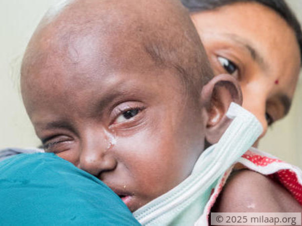 Baby Lakshana's Immune System Has Given Up On Her, You Can Help Her