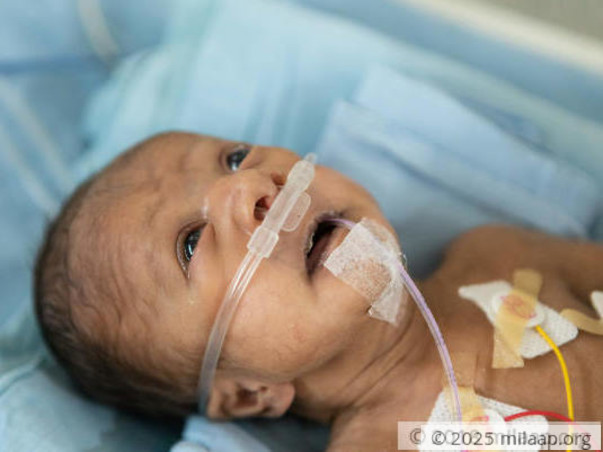 Premature Baby Born With A Hole In The Heart Needs Treatment