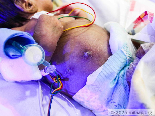 Baby of Lucky needs your help to fight disease