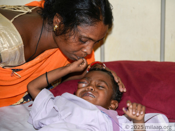 This 3-Year-Old's Eye Looks Like It'll Burst Because Of Cancer