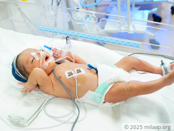 Baby of Renu needs your help to survive