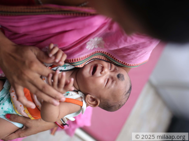 Daily Wager's Daughter Needs Urgent Surgery To Survive Heart Disease