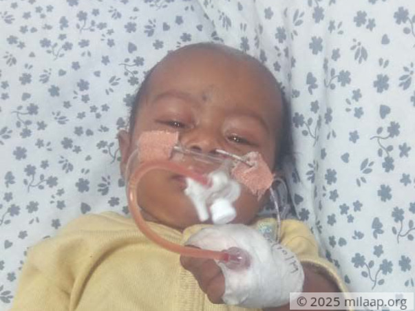 Help Amala's Baby Fight Infantile Dengue With Severe Pneumonia