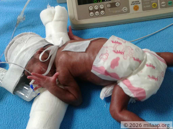 My Yash Was Born When I Was Only 6 Months Pregnant