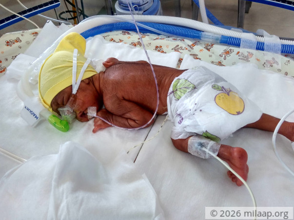 Twins Born After 26 Years Of Marriage Are Now Fighting To Survive