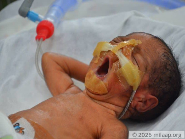 Twins Born After 26 Years Of Marriage Are Now Fighting To Survive