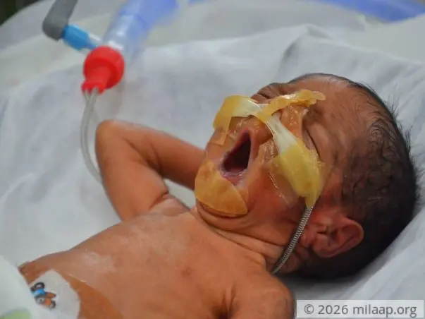 Twins Born After 26 Years Of Marriage Are Now Fighting To Survive