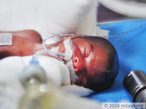 Help Akshaya and Mayur save their prematurely born twins