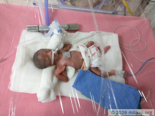 Help Sujata and Pravin save ther prematurely born babies