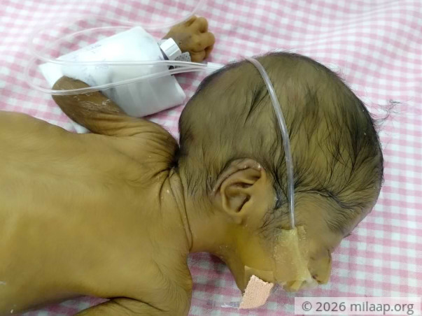 I Waited 13 Years To Be A Mother, Now My Twins Are Fighting To Live