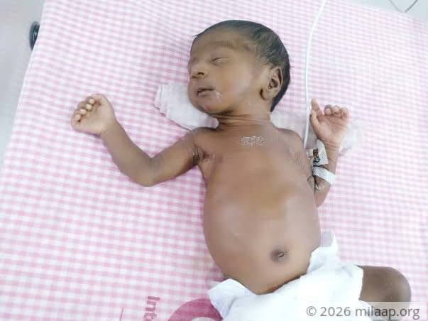 I Waited 13 Years To Be A Mother, Now My Twins Are Fighting To Live