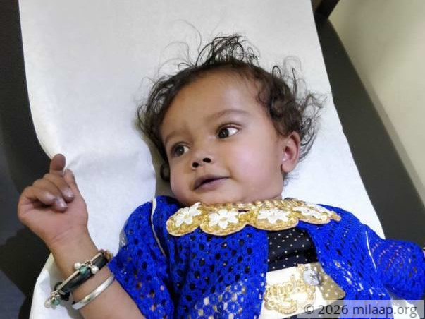 1-Year-Old Baby Disha's Failing Heart Has Almost Killed Her Twice