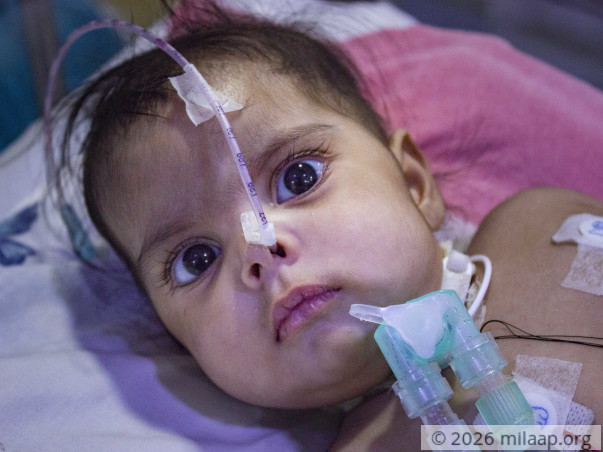 Teacher Struggles To Save His 6-month-old Baby From Lung Infection