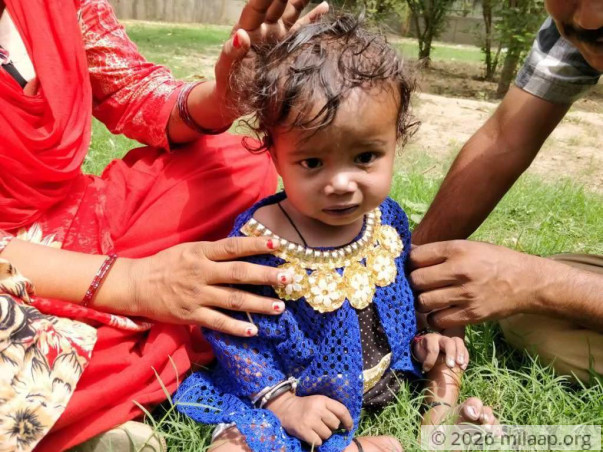 1-Year-Old Baby Disha's Failing Heart Has Almost Killed Her Twice