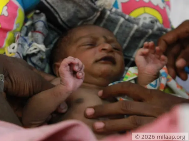 Farmers Have Only 1 Week Left To Save Baby With Multiple Heart Defects