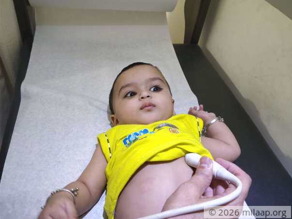 11-month-old's Heart Will Give Up On Him Without Urgent Surgery