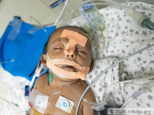 Savita's Newborn May Need A 3rd Surgery If He Cannot Get PICU Care