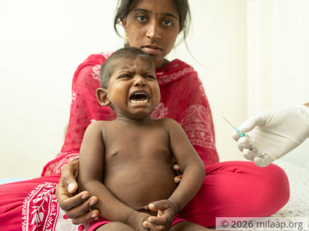 2-year-old Will Scratch Himself To Death Without Liver Transplant