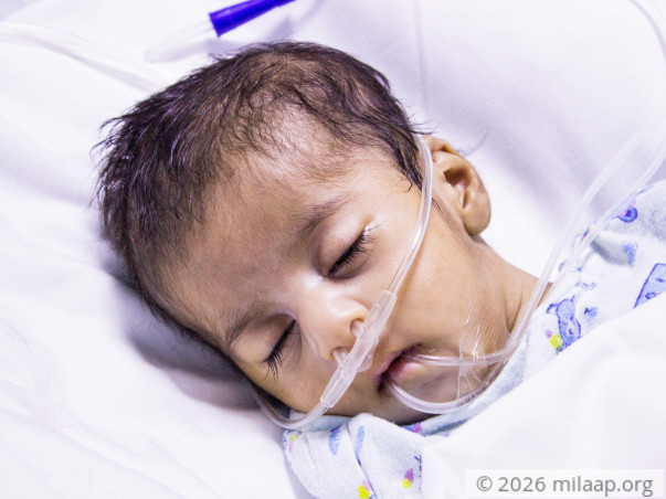 Mother Cannot Afford To Save 2-month-old Whose Own Saliva Chokes Lungs