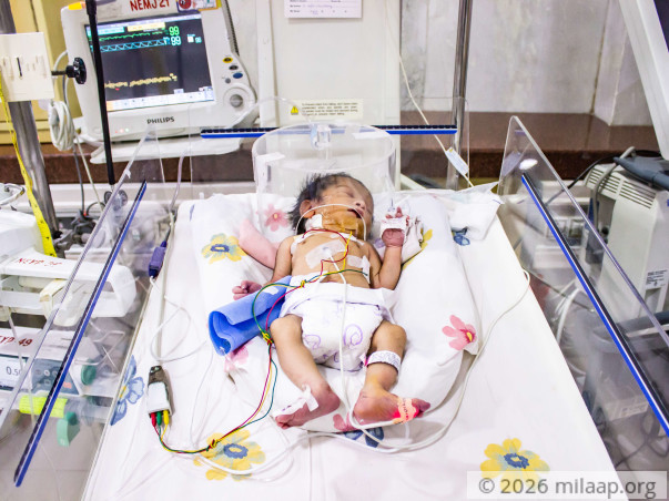 This 2-day-old's Intestines Are Pushing Into His Heart and Lungs
