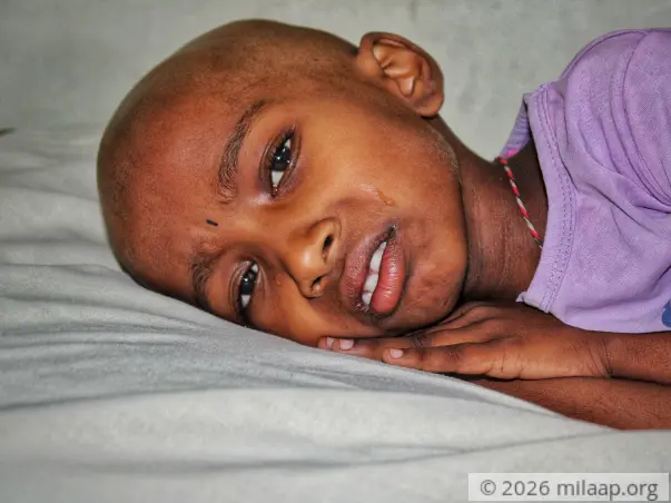Cancerous Tumors On This 8-Year-Old's Kidney Can Kill Her