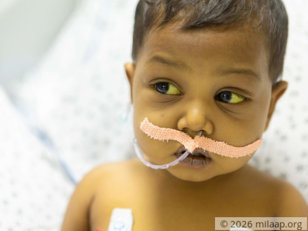 Only a liver transplant can save baby Ayesha