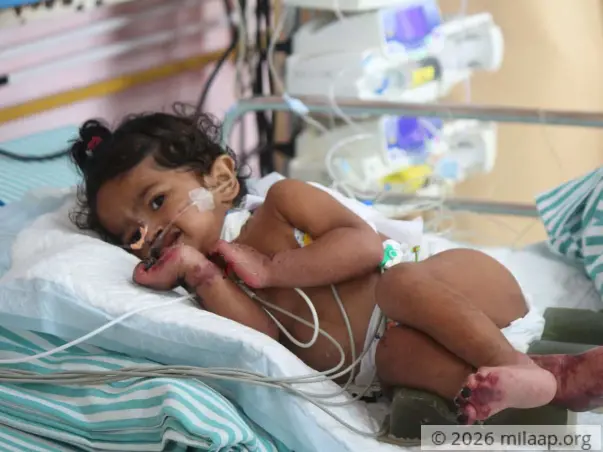 10-Month-Old Baby Girl Will Lose Her Limbs And Life To Gangrene