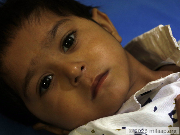 Farmer's 3-Year-Old Son Needs An Urgent Heart Surgery To Survive