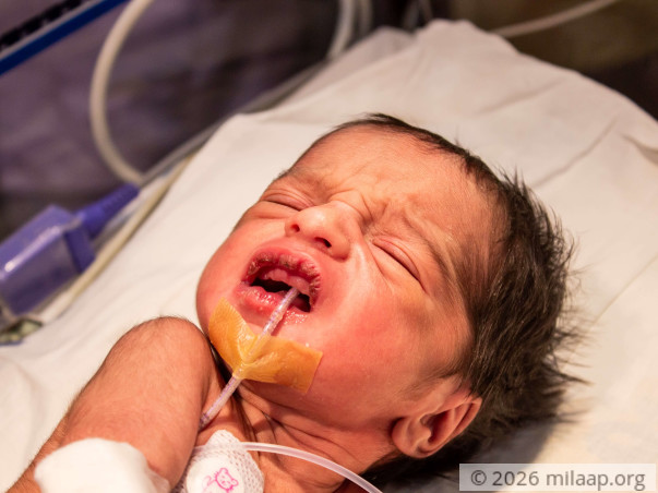 Farmer's 11-Month-Old Who Hasn't Eaten Since Birth Needs Urgent Help