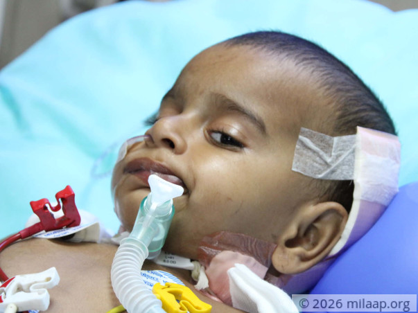 Sharvesh's brain tumor has paralysed him, he needs help to live