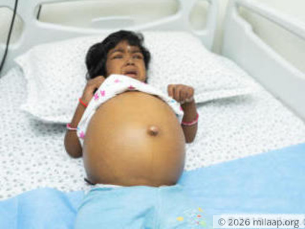 3-year-old's Stomach Is Swollen To The Size Of A Football
