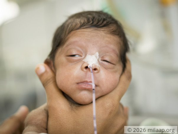 Help Shahin save her twins who were born prematurely