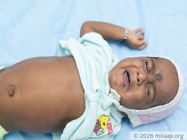 4-month-old Naga Lokesh needs a liver transplant