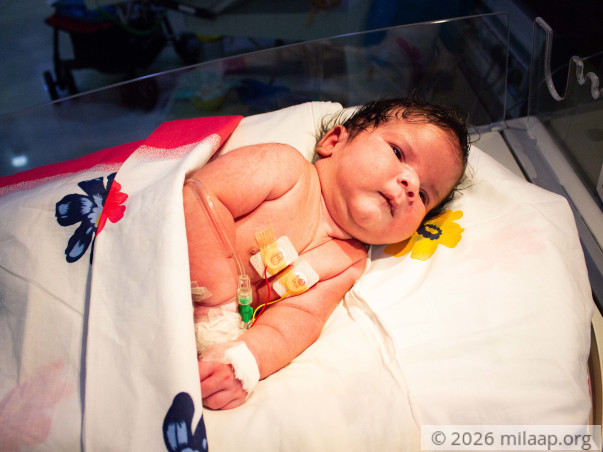 15-day-old baby with hole in the back needs urgent surgery