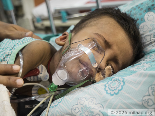 Pneumonia Has Left This 11-Month-Old Face To Face With Death