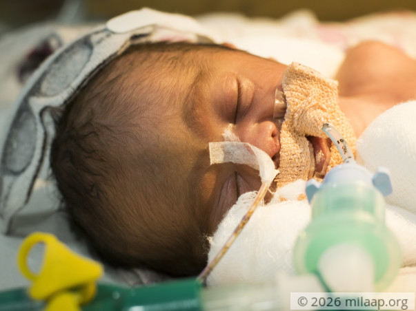 এই অসহায় মা তার নবজাতককে বাঁচানোর প্রাণপণ চেষ্টা করছে