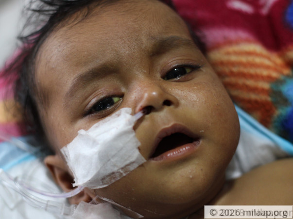 5-Month-Old With Liver Disease Has Few Days Left To Get Transplant