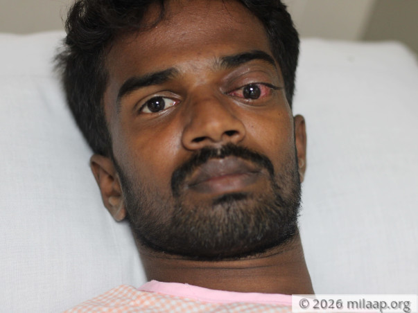 23-YO Suffering From Eye Damage After Cow Attacked Him Needs Help