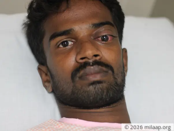 23-YO Suffering From Eye Damage After Cow Attacked Him Needs Help