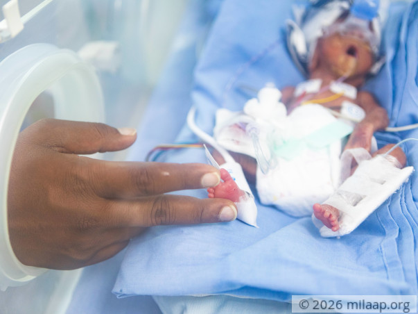 Pharmacist Needs Urgent Help To Save His Premature Baby