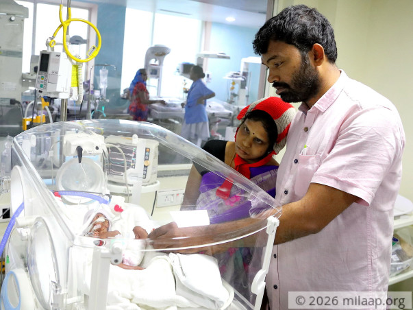 Palm-Sized Twin Babies Weighing Just A Few Grams, Need Urgent Help