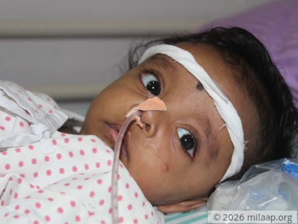 5-Month-Old Chokes Every Time He Cries Because Of Cancerous Tumour