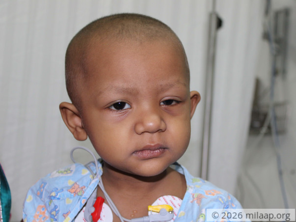 Teacher's 2-Year-Old Will Lose Her Eyesight To Cancer Without Help