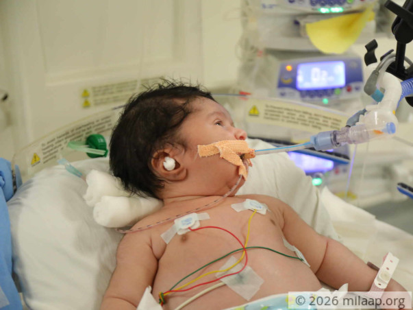 Orphanage Teacher Struggles To Save 10-Day-Old Who Cannot Eat